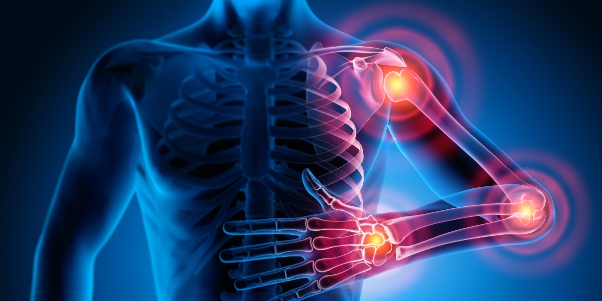 Rheumatology conditions