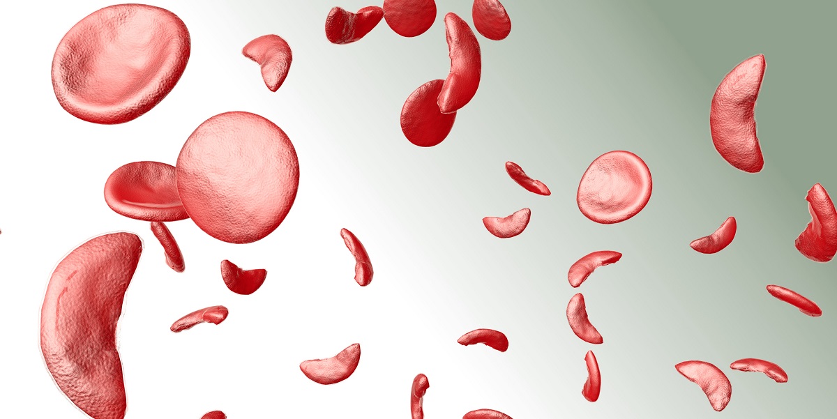 Sickle Cell Anemia  Google Slides  PowerPoint template